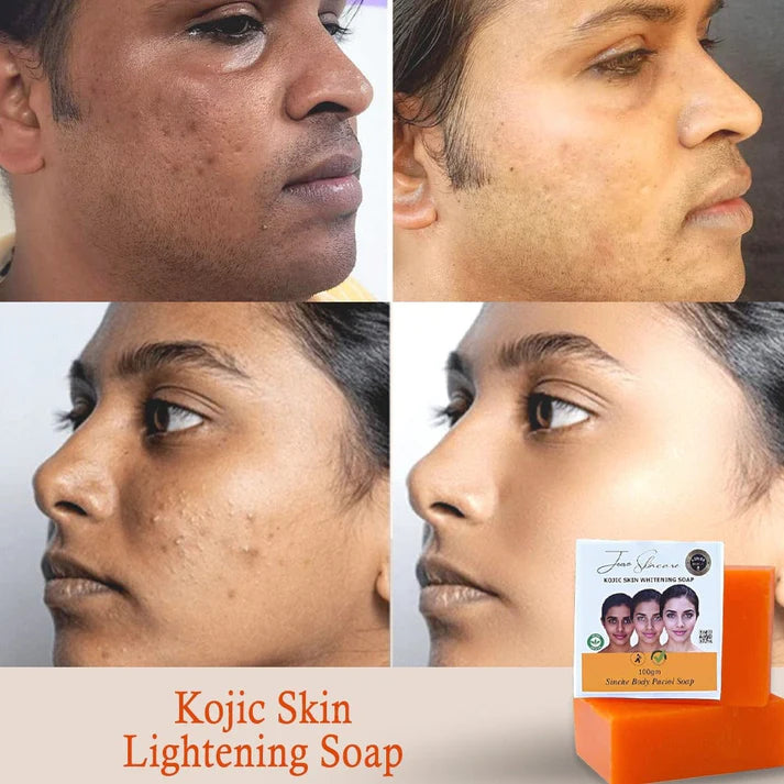 Lucacci Sinche Kojic Skin Whitening Facial Body Soap for Women & Men - 100 g
