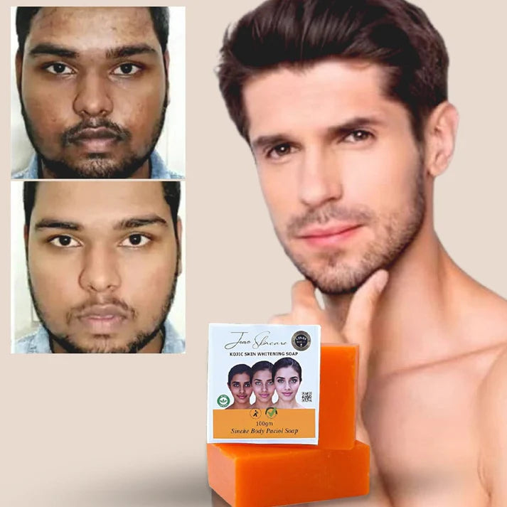 Lucacci Sinche Kojic Skin Whitening Facial Body Soap for Women & Men - 100 g